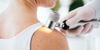 Study helps unravel melanoma mystery