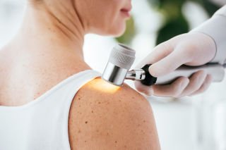 Study helps unravel melanoma mystery