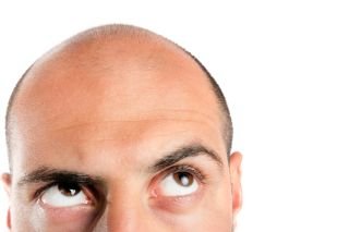 Hold on to your hat – baldness and COVID-19 don’t mix!