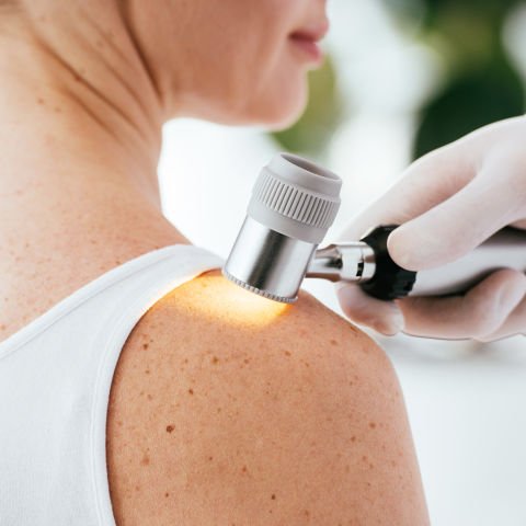 Study helps unravel melanoma mystery