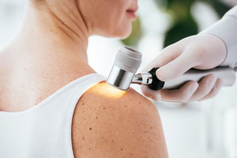 Study helps unravel melanoma mystery